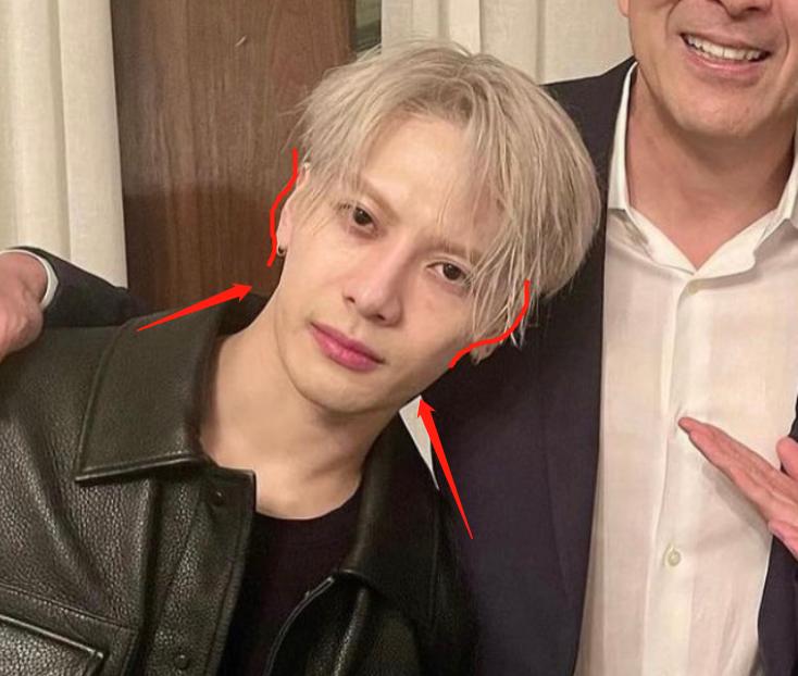 深度解析明星整容后遺癥，觀點與影響探討