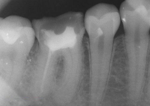 中國(guó)再生牙齒研究新進(jìn)展，重塑微笑，科技引領(lǐng)牙齒再生新篇章