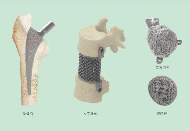 三維打印髖關節(jié)技術新動態(tài)，重塑生活的科技魔法奇跡