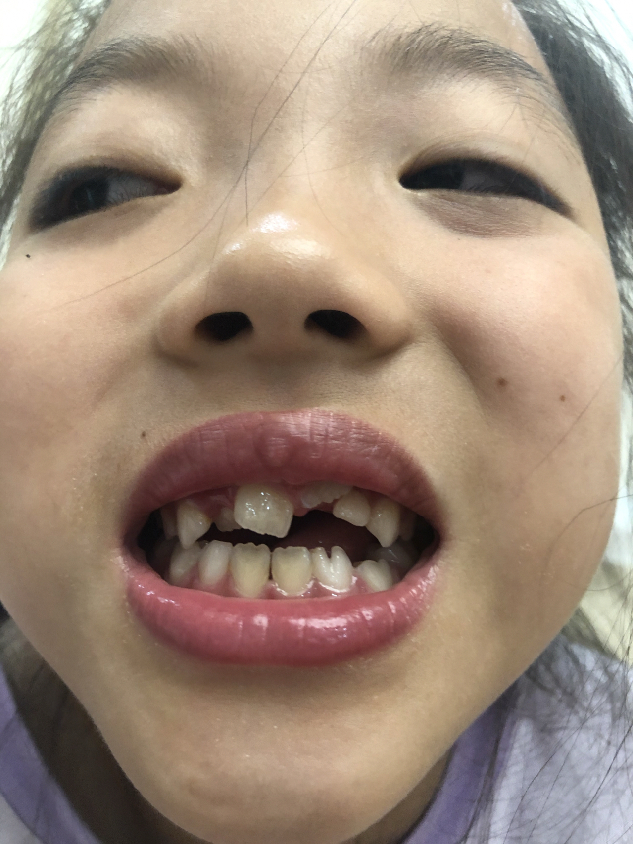 莊最新牙齒技術(shù)揭秘，牙齒美容新選擇