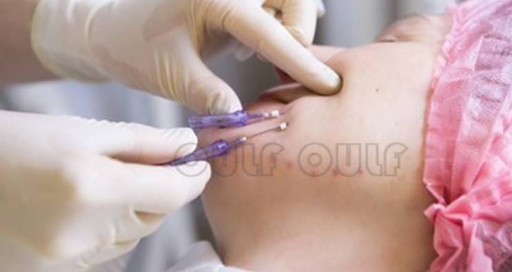 線雕最新手法，背景、發(fā)展、時代地位及展望